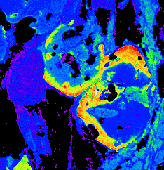 Distribution of Cr in a metamorphic garnet